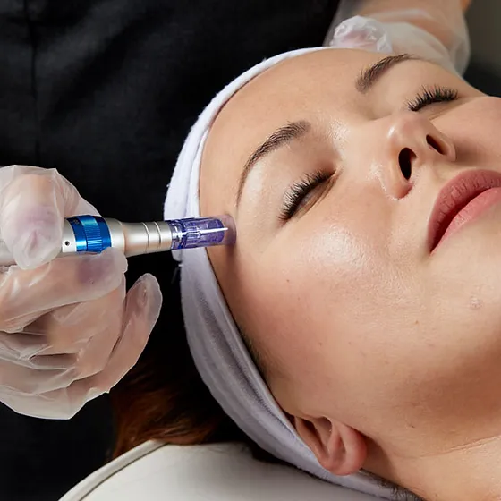 مزونیدلینگ ابرو